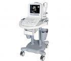 CHISON 8300 全数字化黑白便携超声诊断仪