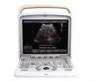 CHISON Q5 全数字彩色超声诊断系统