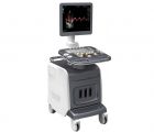 CHISON iVis60EXPERT  高档彩色多普勒超声诊断系统